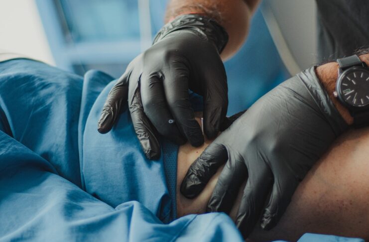 Botox treatment