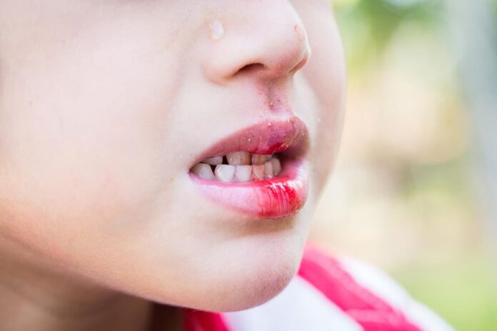 What to Do When You Suffer Mouth Trauma